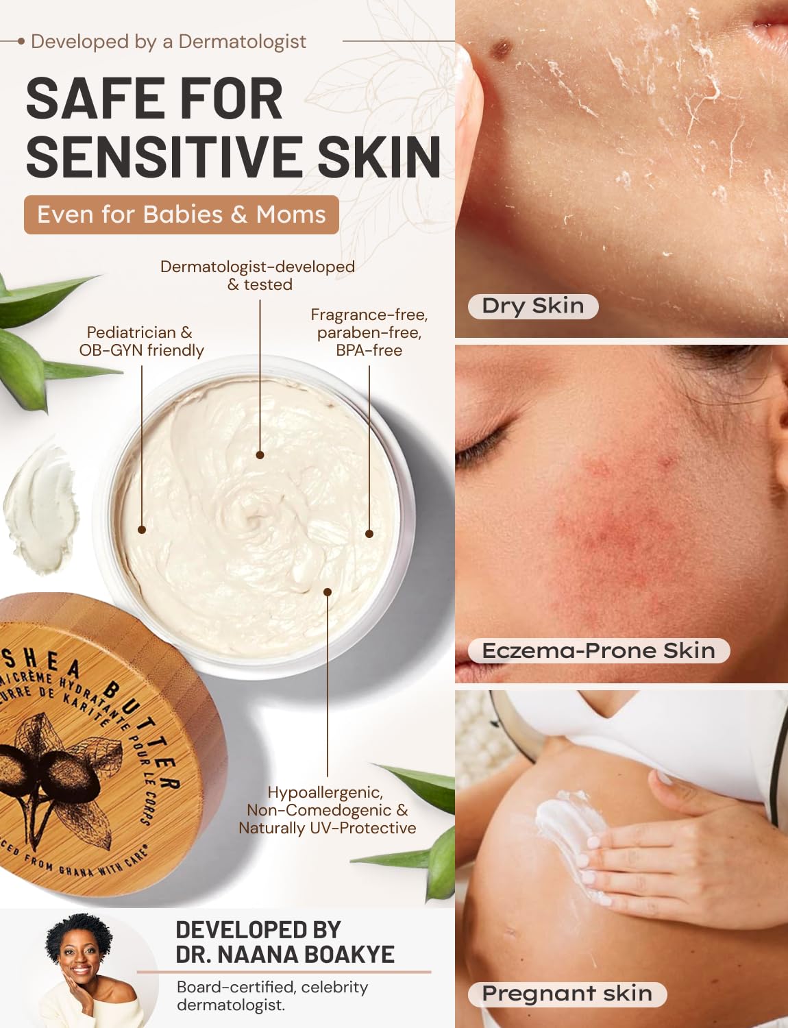 Karité Crème Corps Mini Shea Butter Body Cream | Hydrating Moisturizer for Dry & Sensitive Skin | Dermatologist-Formulated and Approved | Cruelty-free & Hypoallergenic for all Skin Types - 1.7fl oz