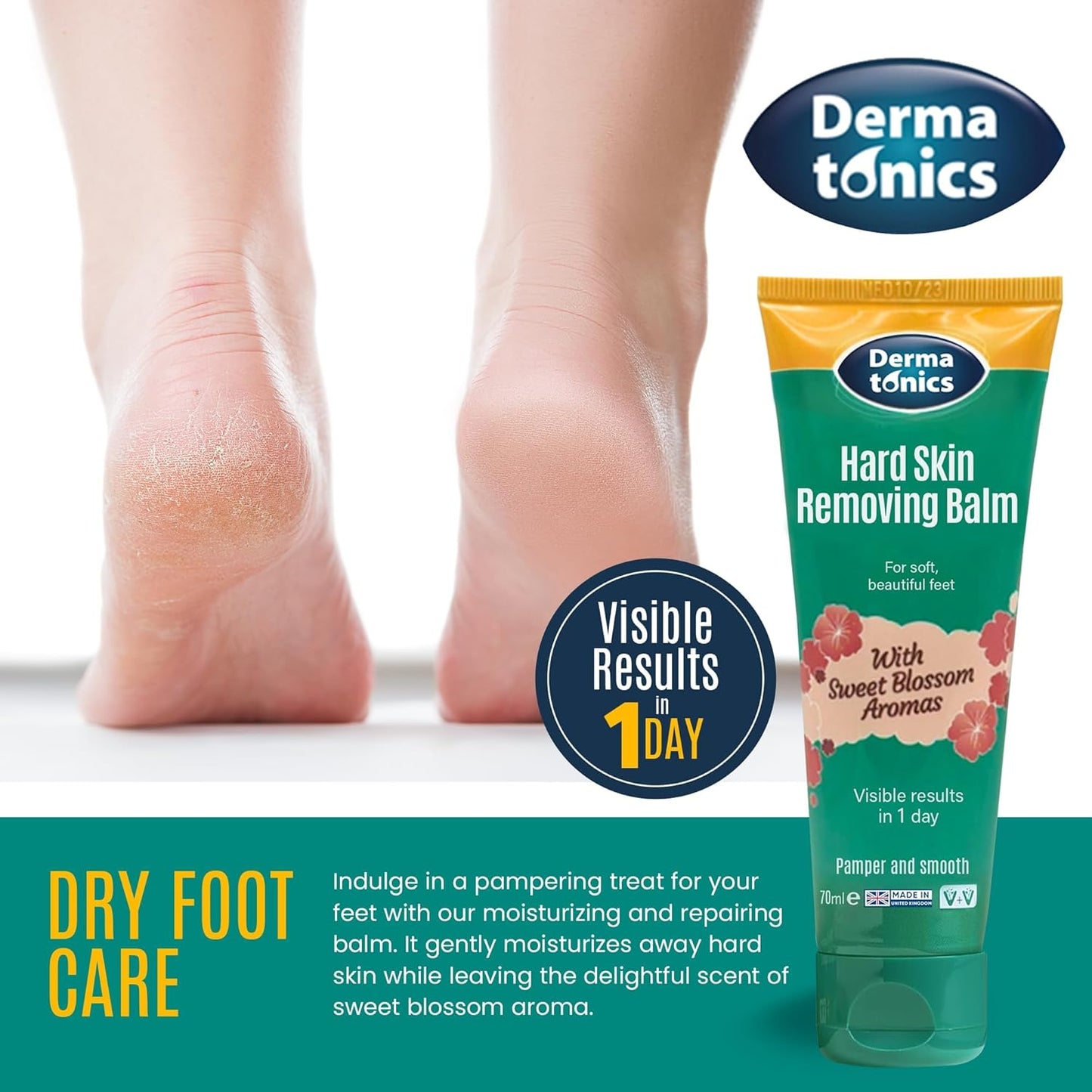 10% Urea Callus Removing Cream – Removes Hard Skin, Moisturizes and Rehydrates Racked, Rough, Dead and Dry Skin – for Feet, Elbows, and Hands, 2.37 fl oz. Tube, 3 Pack