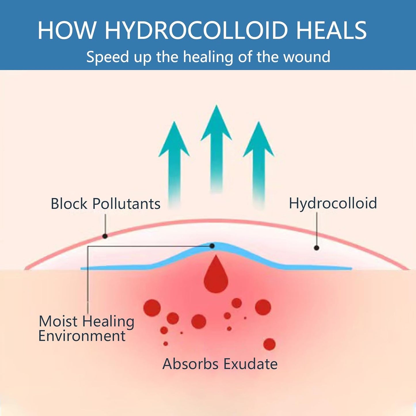 Hydrocolloid Bandages Roll for Wound Care – Cut-to-Size | Self-Adhesive Hydrocolloid Roll for Burns, Blisters & Acne | Waterproof, Ultra-Absorbent, ER-Approved First Aid Essential (2in*16ft)