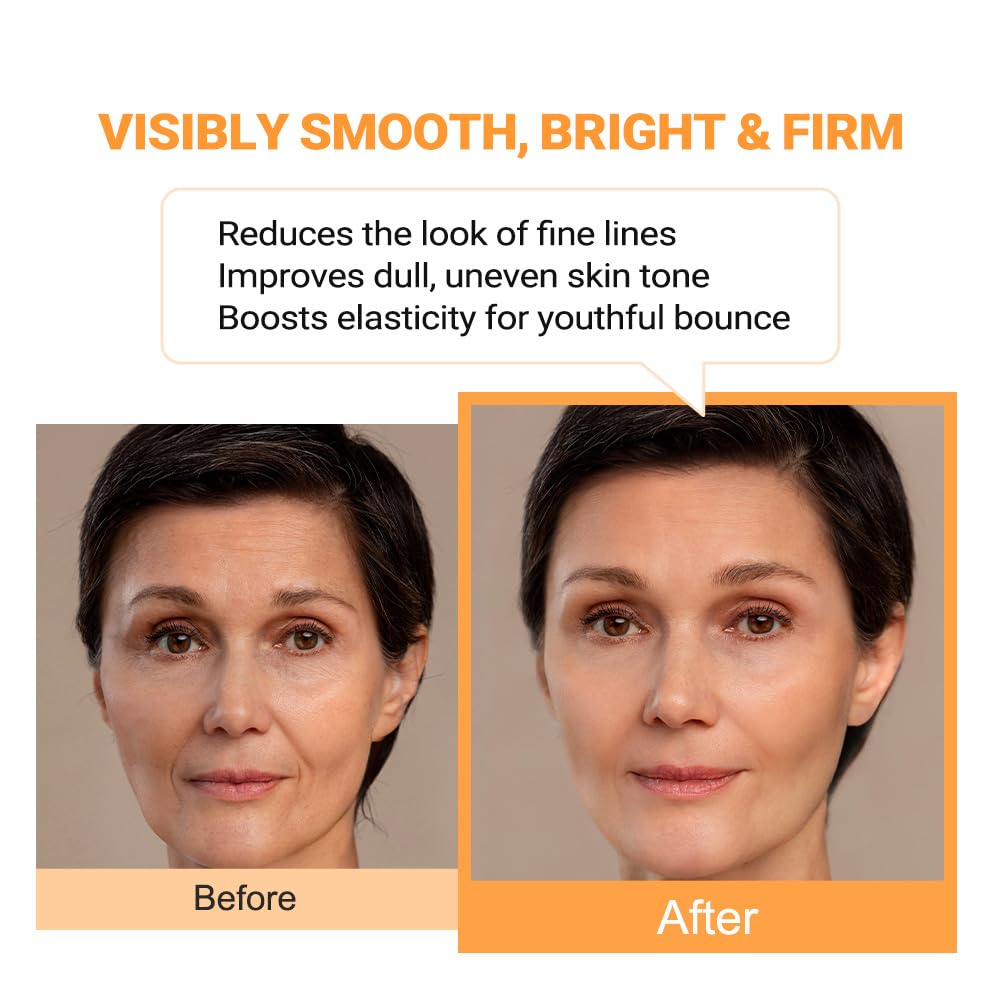 Puretiful Vitamin B12 Lotion (1 oz) | Repair & Hydrating Cream for All Ages （teen & adult)| Soothes Redness, After-Sun Skin Relief, Strengthens Barrier, Sensitive Skin Safe