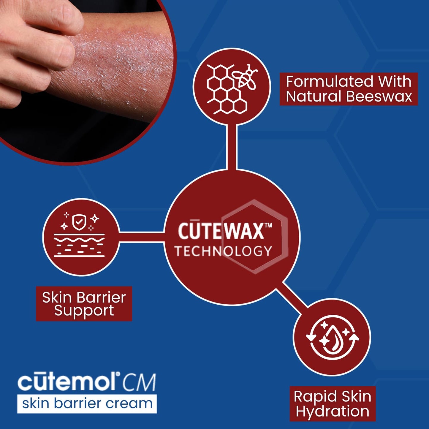 Cutemol CM Emollient Cream - Natural Beeswax & Ceramides for Dry, Damaged Skin (2.75 oz)