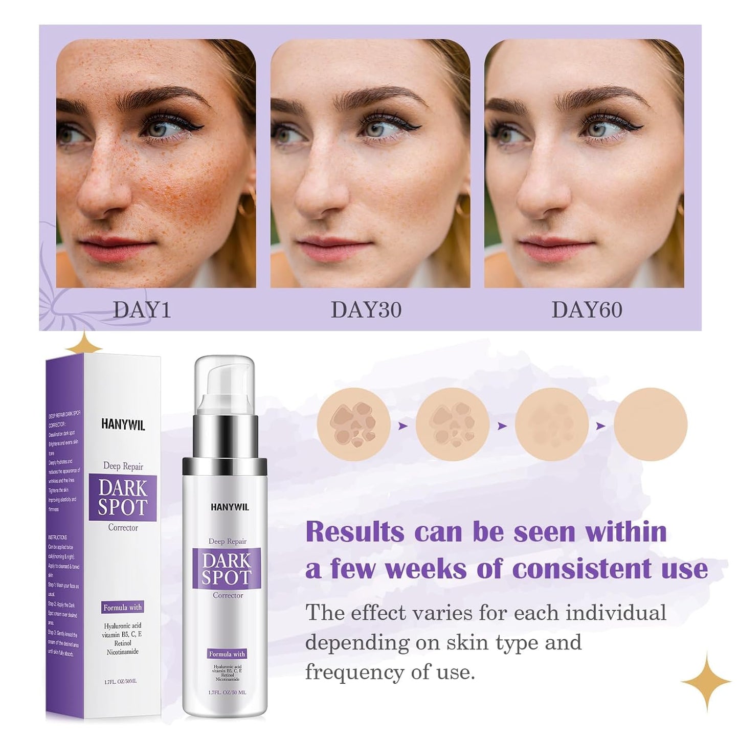 HANYWIL Dark Spot Remover for Face & Body Serum,Rapid Tone Repair Cream with Hyperpigmentation Treatment,Sun Spot, Age Spot & Melasma Remover,Dermatologist-Tested Brightening Retinol Serum (1.7 Fl Oz)