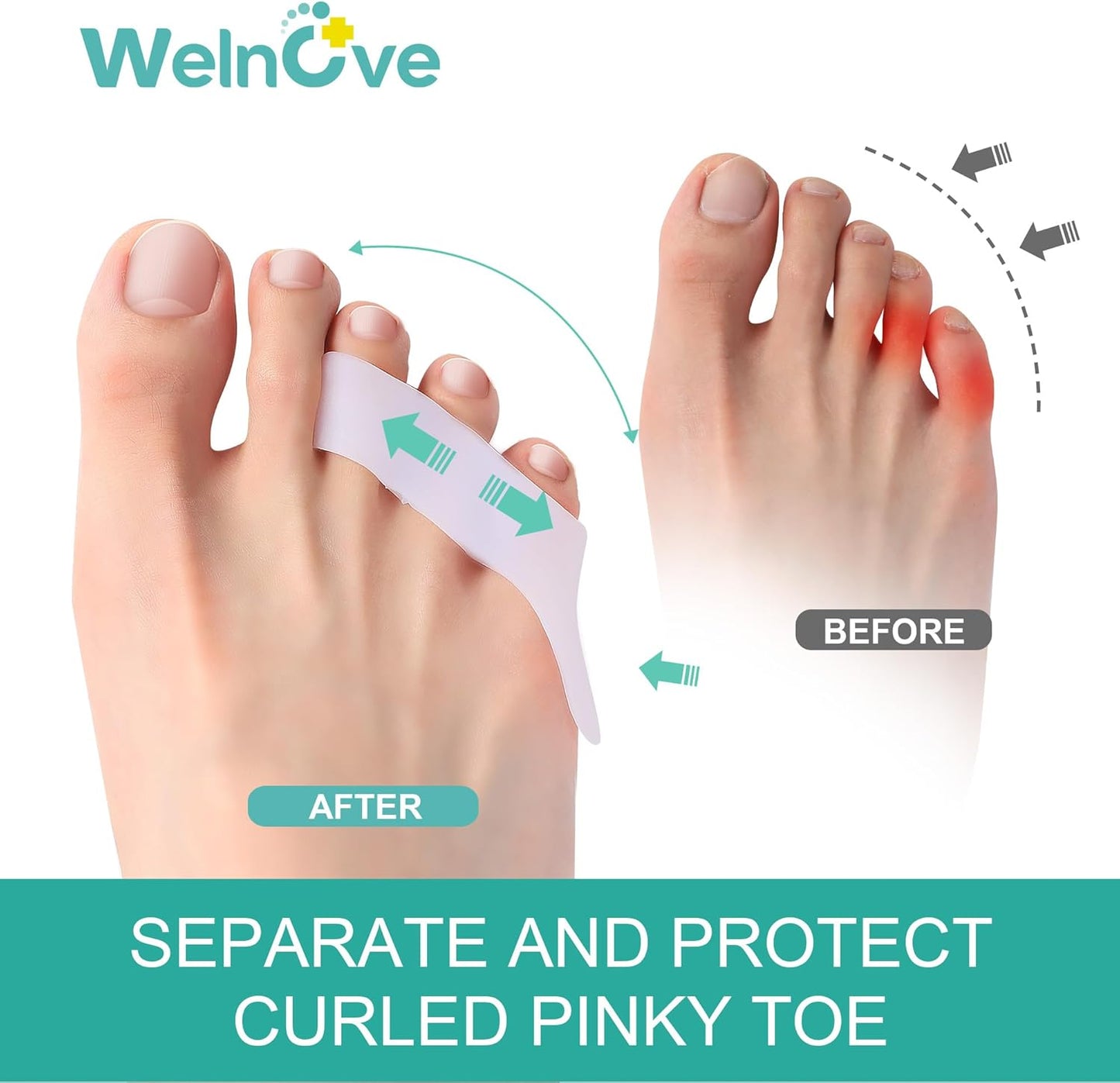 Welnove Gel Pinky Toe Separators - 8 Pack Pinky Toe Spacers, Bunion Cushions Pads for Women＆Men, Silicone Little Toe Protectors for Preventing Rubbing & Relieve Pressure(White)