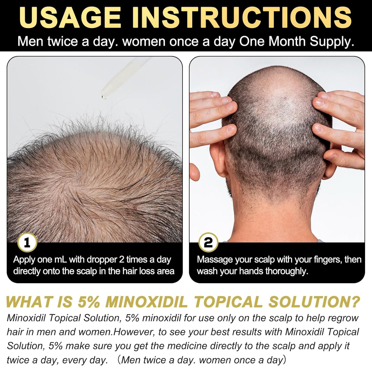 5% Minoxidil for Men and Women Hair Growth Serum, Biotin Hair Growth, Hair Regrowth Treatment for Scalp Hair Loss Hair Thinning for Thicker Longer Fuller Healthier Hair (Pack of 2)