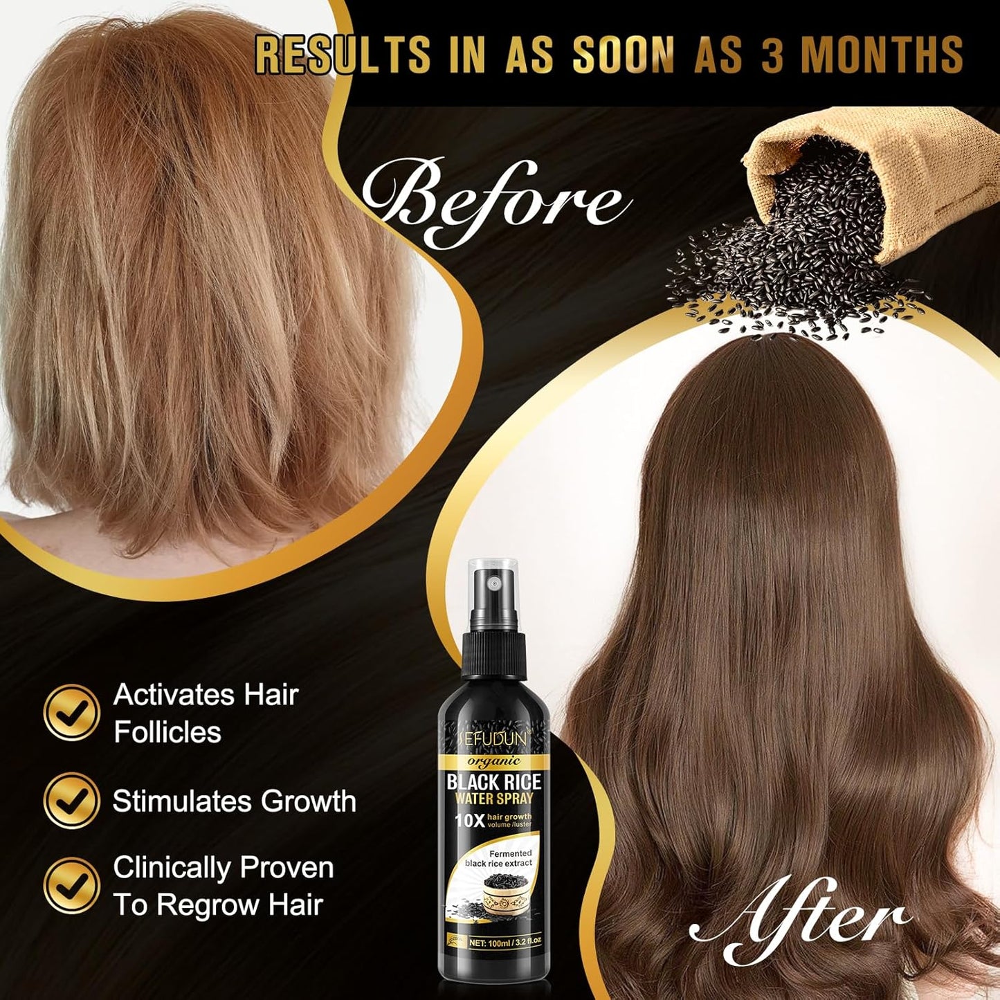 Organic Black Rice Water Spray for Hair Growth, A Solution with Castor Oil & Ginger Root Extract for Thicker, Fuller Hair, Targets Hair Loss and Repairs Damage 200ml/6.4 fl.oz (2 PC)