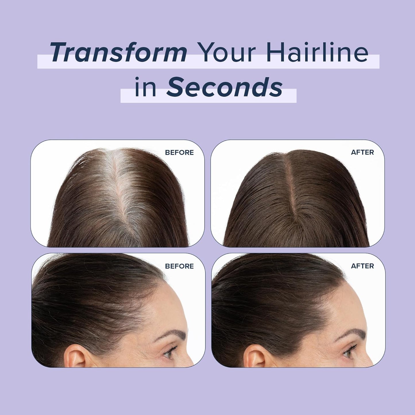 TRUHAIR Root & Scalp Cover Up Pressed Powder Compact, Waterproof, Weightless Hair Coverage & Bald Spot Concealing, Root Touch Up Hair Color for Gray Coverage & Thinning Areas, 0.35 Oz (Light Brown)