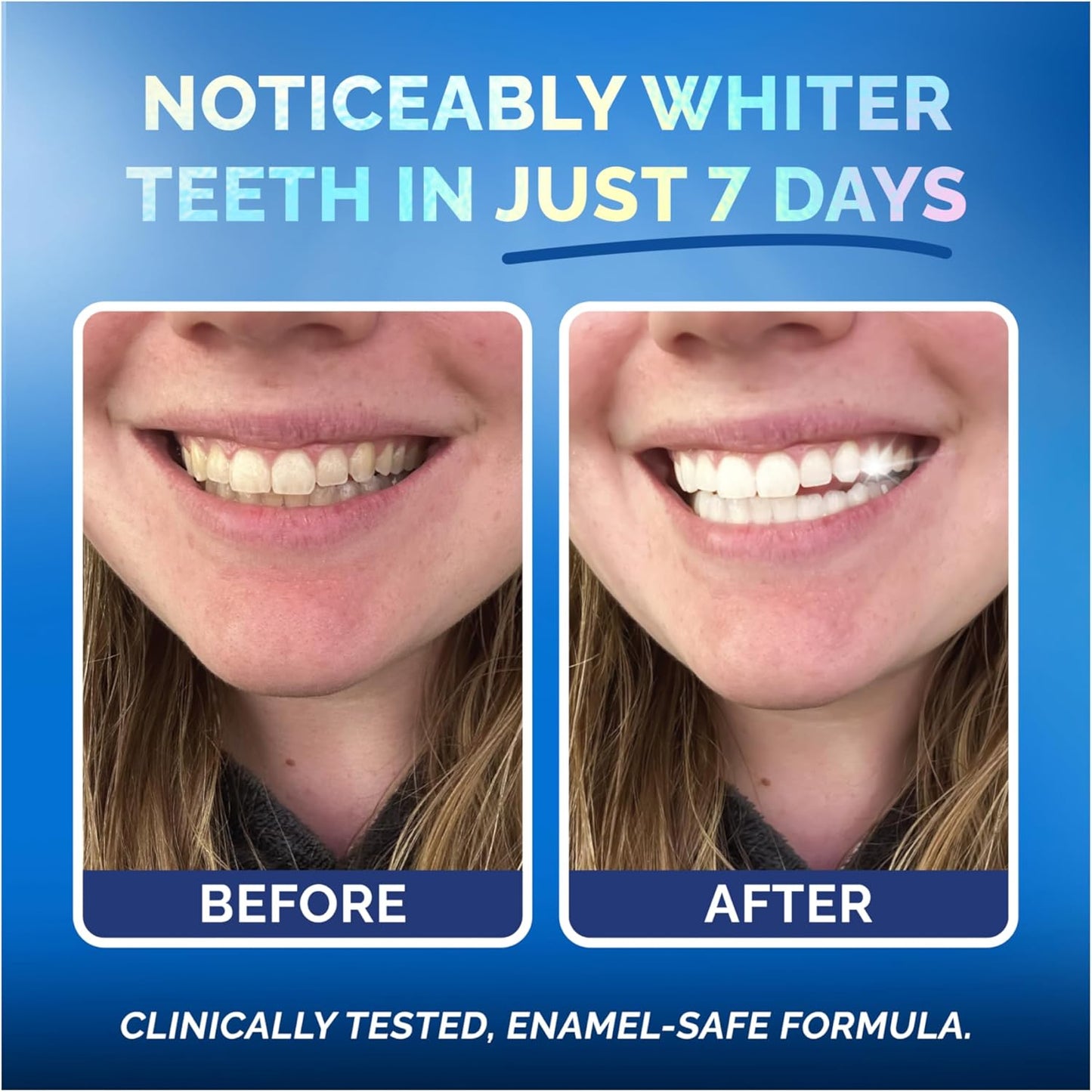 Whitening Strips for Sensitive Teeth – Enamel Safe, Peroxide-Free Coconut Teeth Whitening Strips with Natural Enzymes – Gentle White Stips for Sensitive Gums (14 Count, Mint)