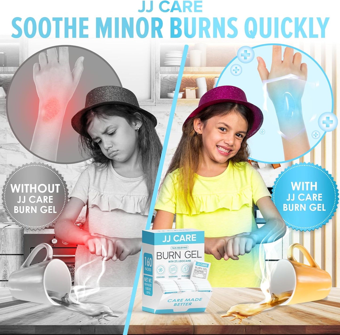 JJ CARE Burn Gel (Pack of 160), Soothing Burn Gel Packets for Minor Burns, First Aid Jel & Sunburn Relief Individual Packets with Lidocaine and Aloe Vera (0.9 Grams per Packet)