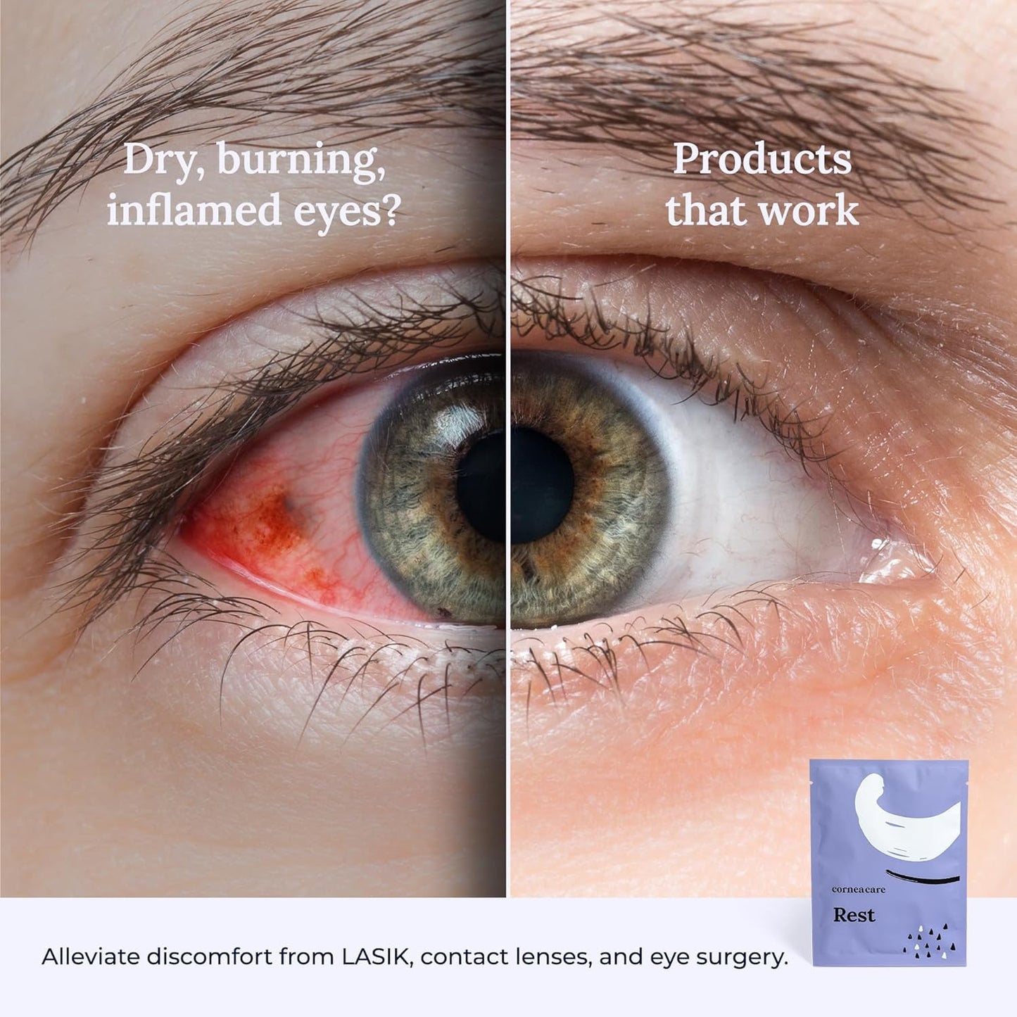 Rest: Self Heating Warm Compress for Dry Eyes | Heated Eye Mask for Fast Relief | No Microwave or Washcloth Needed | Travel Ready | 30 Count